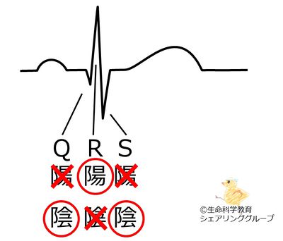 QRS波の極性.jpg