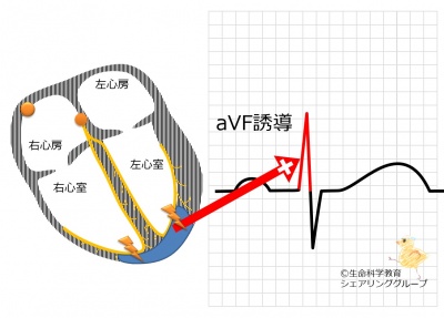 AVF誘導_R波の意義.jpg