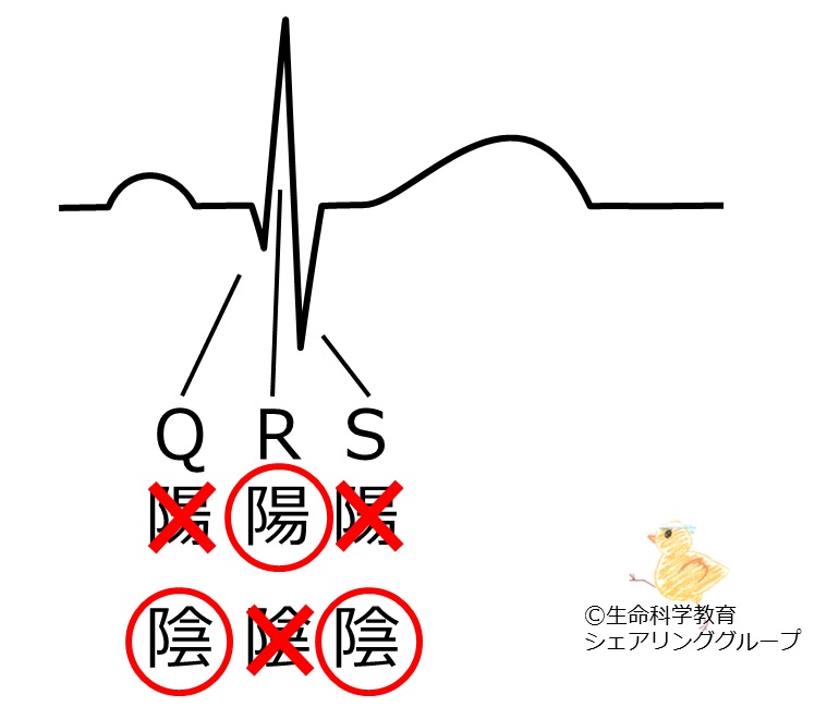 ファイル:QRS波の極性.jpg