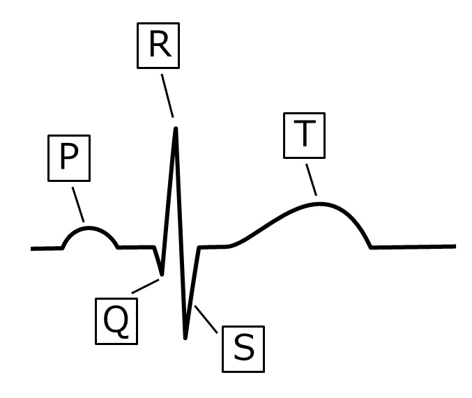 Electrocardiogram wave.jpg
