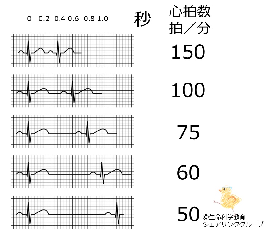 心拍数 ラグ 毛細 心電