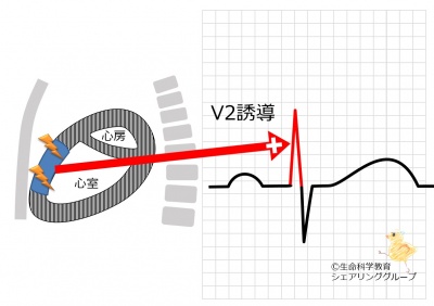 V2誘導_R波の意義.jpg
