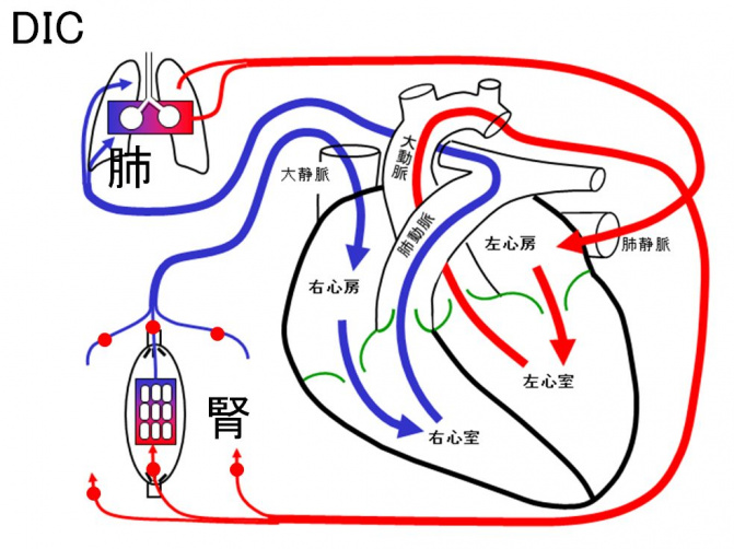 循環障害/循環器系/病態生理学/循環障害/基本的病態による分類