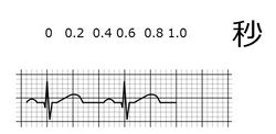 ./images/250px-心拍数クイズE.jpg