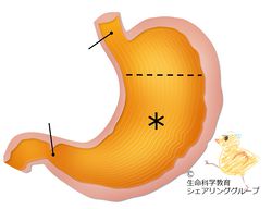 楽天市場】消化器系 ポスター J9860PL 胃 胃壁 盲腸 肝臓