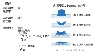 /wiki/images/thumb/5/5e/GastricCancerIntro-Jpn.jpg/400px-GastricCancerIntro-Jpn.jpg