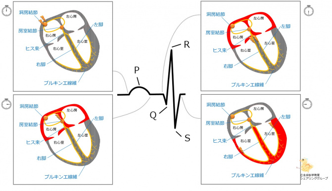 P波のはじめQ（R）波のはじめ.jpg