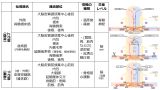 Spinal-tracts-basic-Jpn.jpg