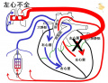 2011年4月8日 (金) 11:20時点における版のサムネイル