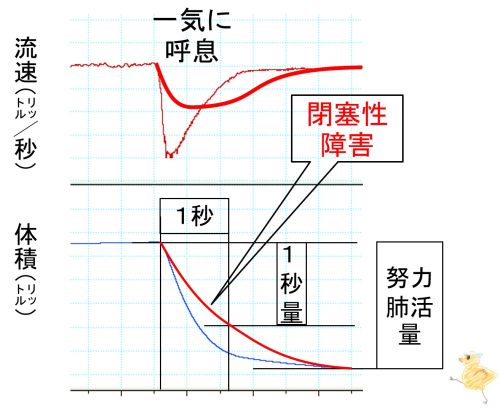 PulmFuncTestObstructive-basic.jpg