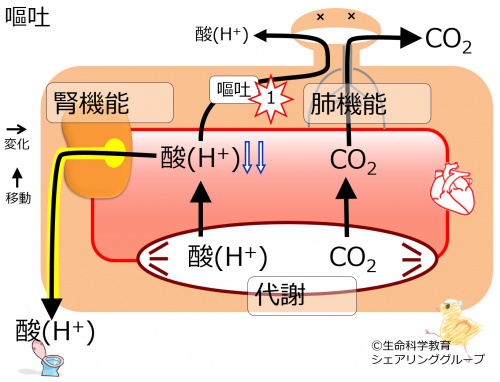 Vomiting2metabolic-alkalosis.jpg