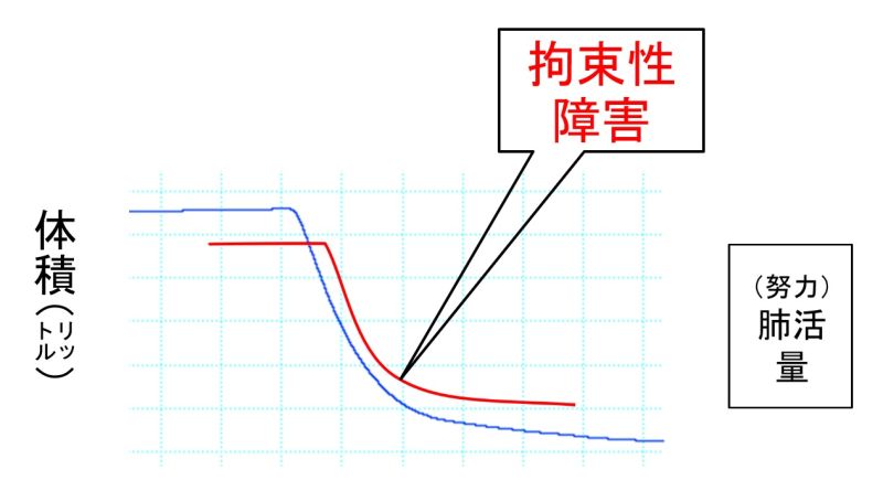 ファイル:PulmFuncTestRestrictive-basic.jpg